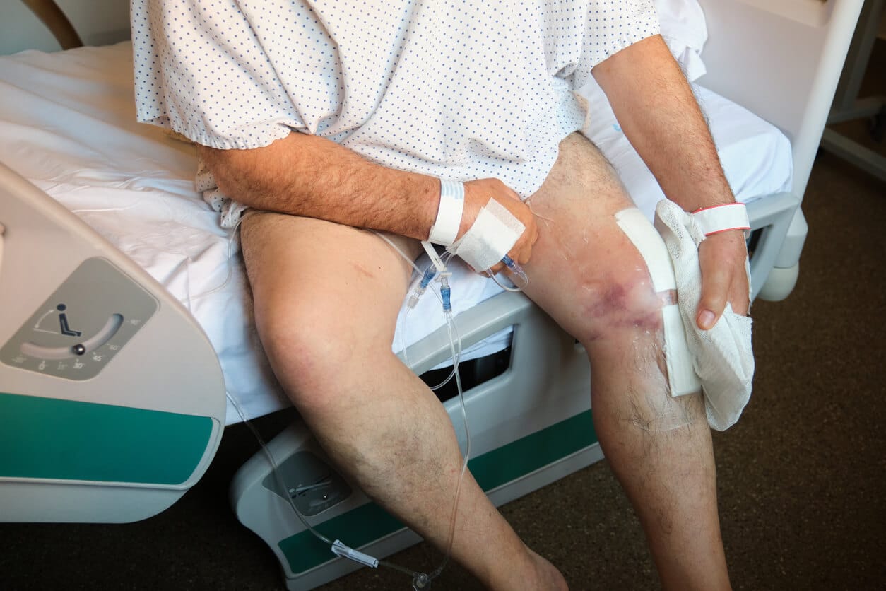 Joint Replacement Surgery